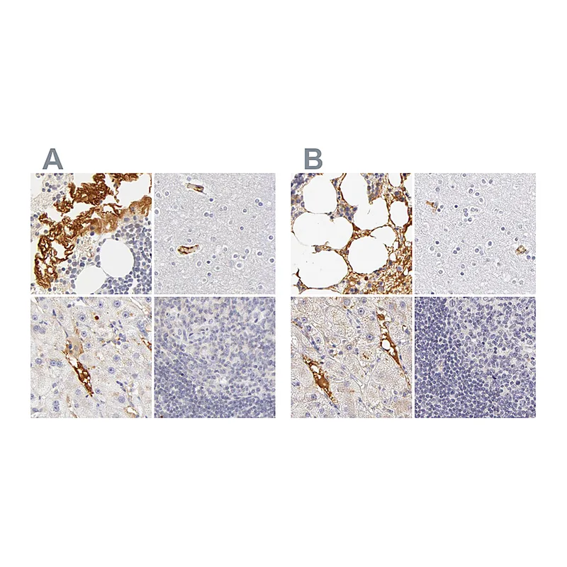 Atlas Antibodies Anti-AHSG Antibody