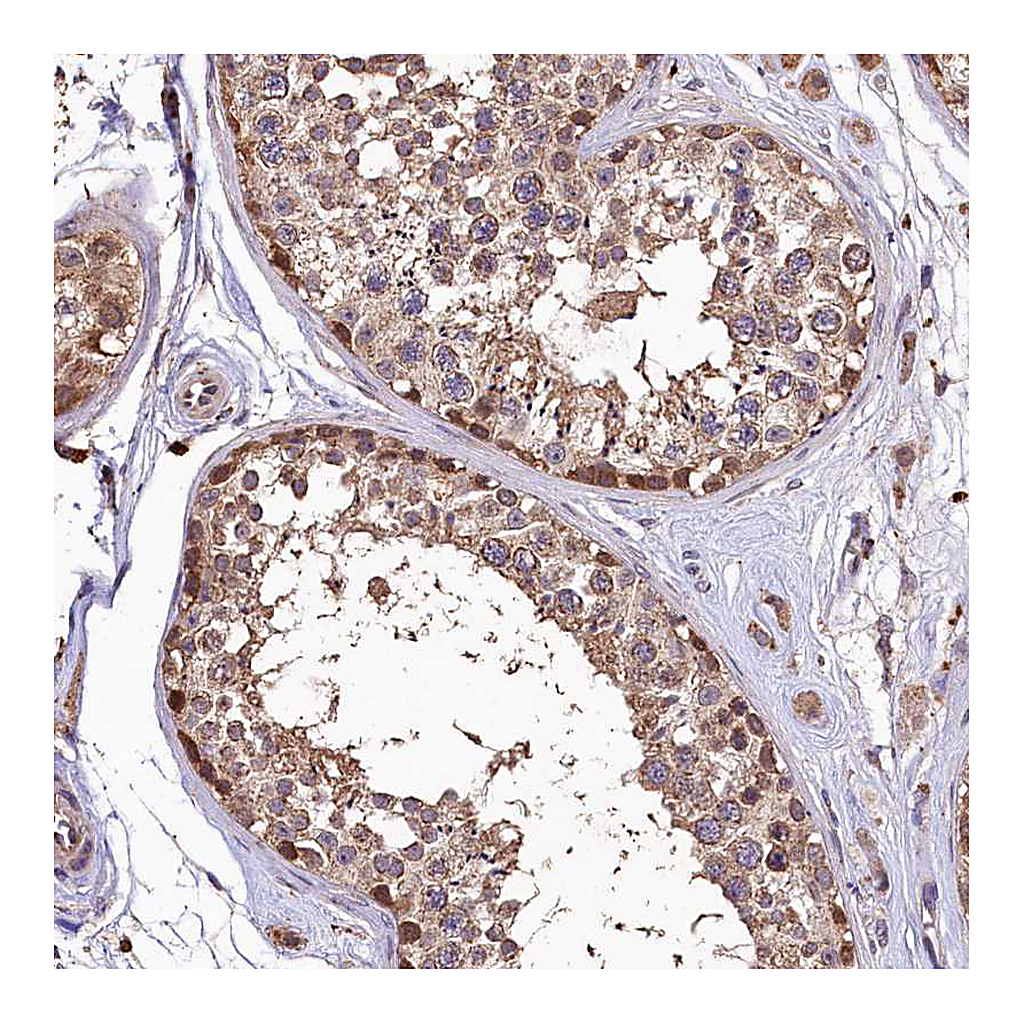 Atlas Antibodies Anti-LSM4 Antibody