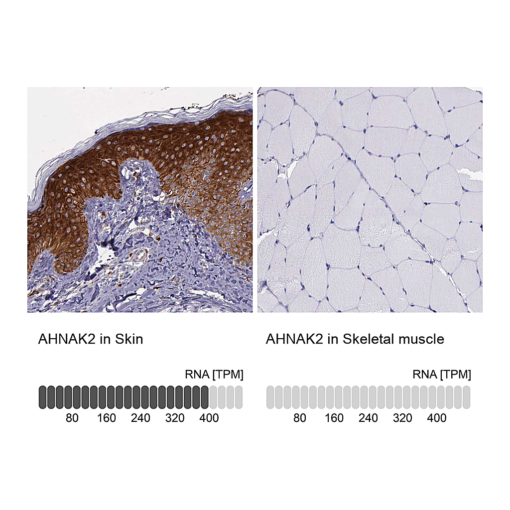 Atlas Antibodies Anti-AHNAK2 Antibody