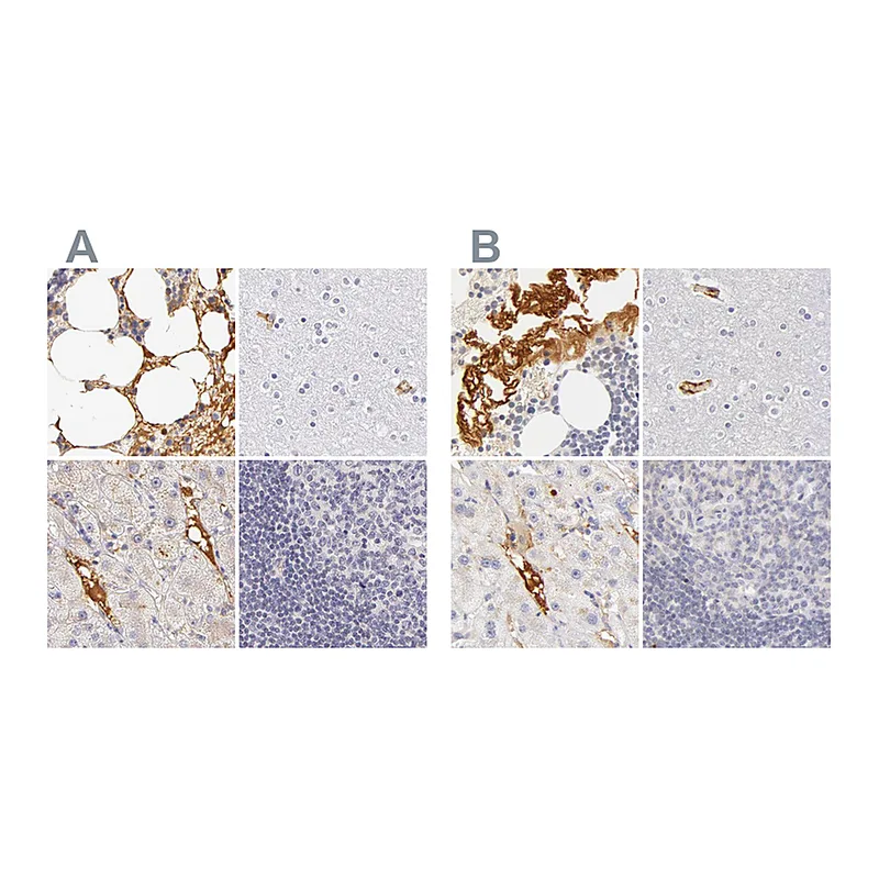 Atlas Antibodies Anti-AHSG Antibody