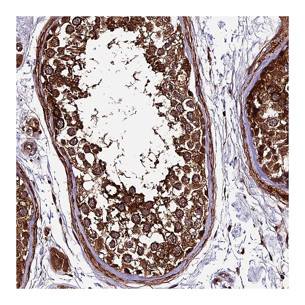 Atlas Antibodies Anti-LSM7 Antibody