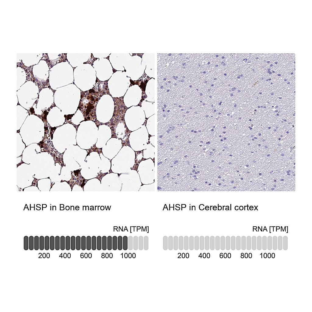 Atlas Antibodies Anti-AHSP Antibody