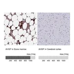 Atlas Antibodies Anti-AHSP Antibody
