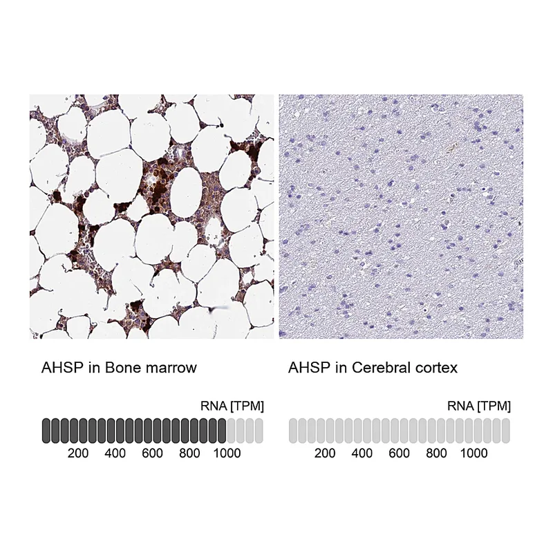 Atlas Antibodies Anti-AHSP Antibody