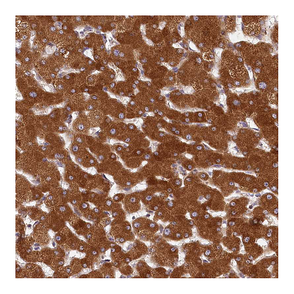 Atlas Antibodies Anti-LSS Antibody