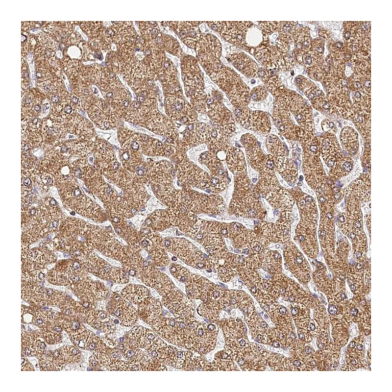 Atlas Antibodies Anti-LSS Antibody