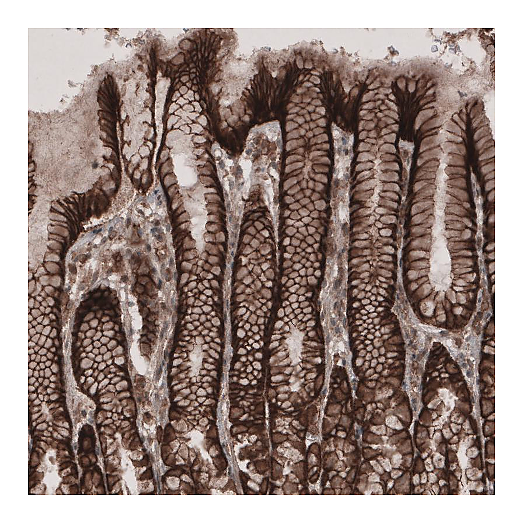 Atlas Antibodies Anti-LSR Antibody