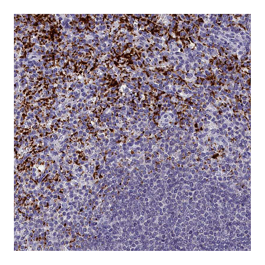 Atlas Antibodies Anti-AIFM2 Antibody