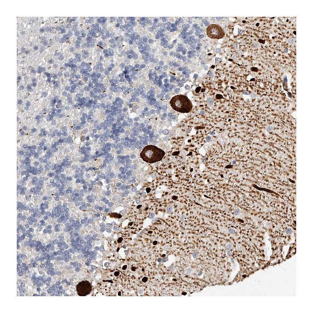 Atlas Antibodies Anti-AIDA Antibody