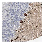 Atlas Antibodies Anti-AIDA Antibody