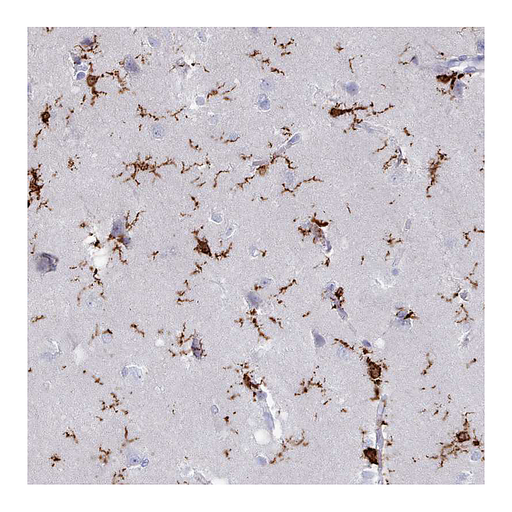 Atlas Antibodies Anti-AIF1 Antibody