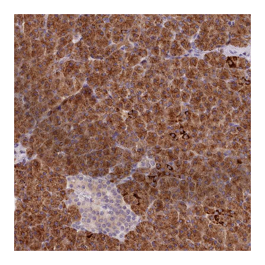 Atlas Antibodies Anti-AIM1 Antibody