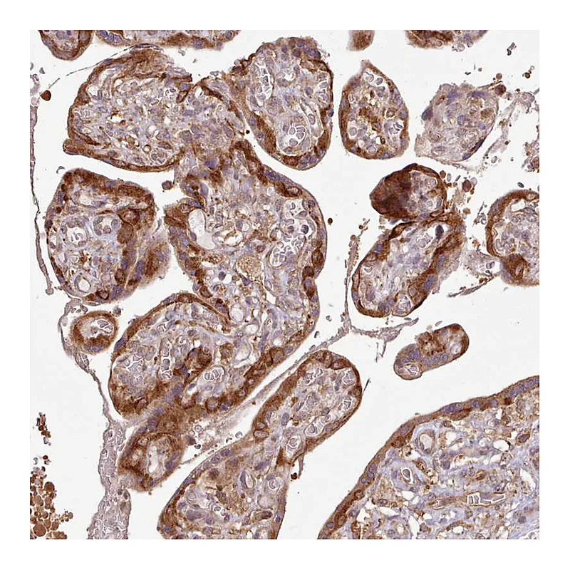 Atlas Antibodies Anti-AIM1 Antibody