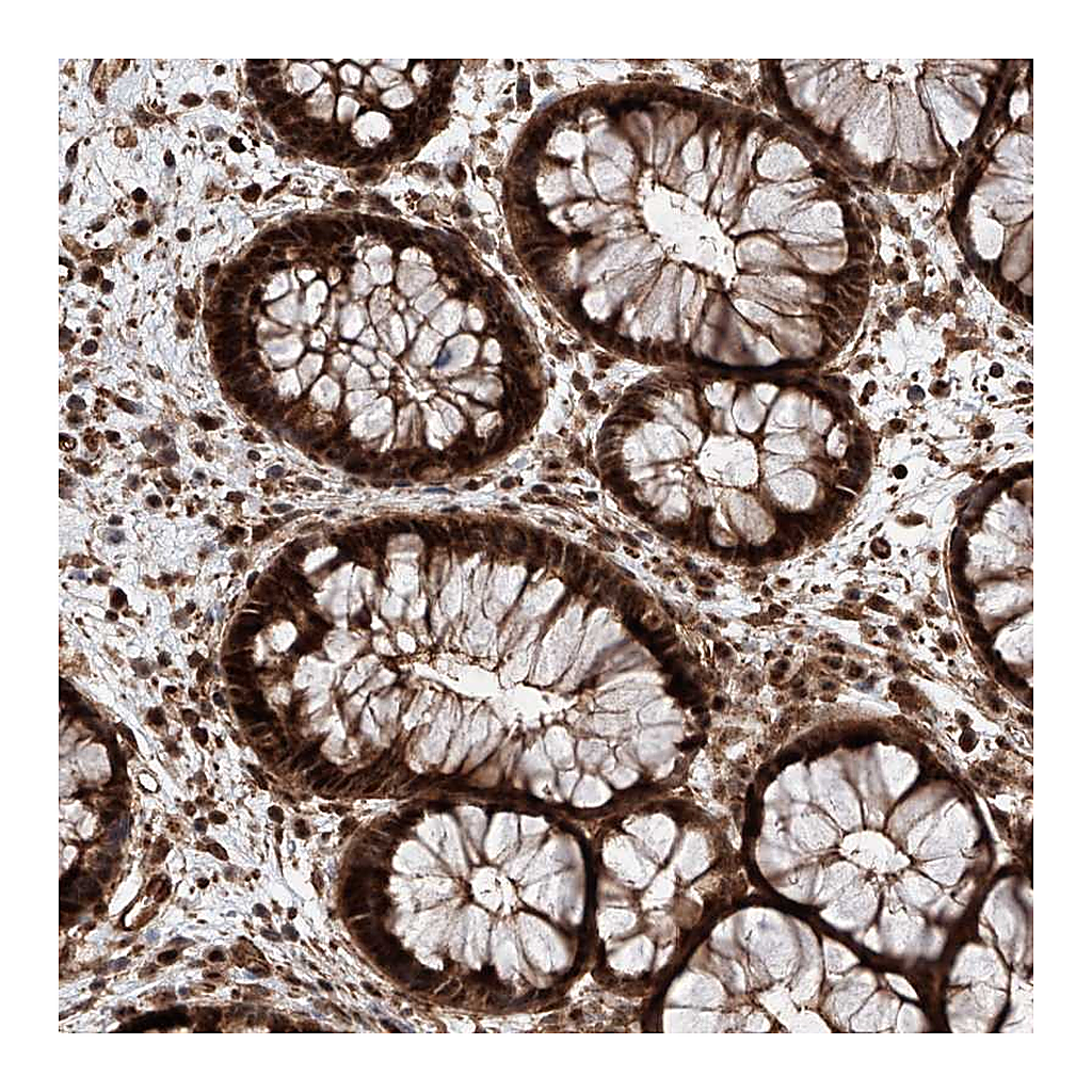 Atlas Antibodies Anti-AIM1L Antibody
