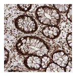 Atlas Antibodies Anti-AIM1L Antibody