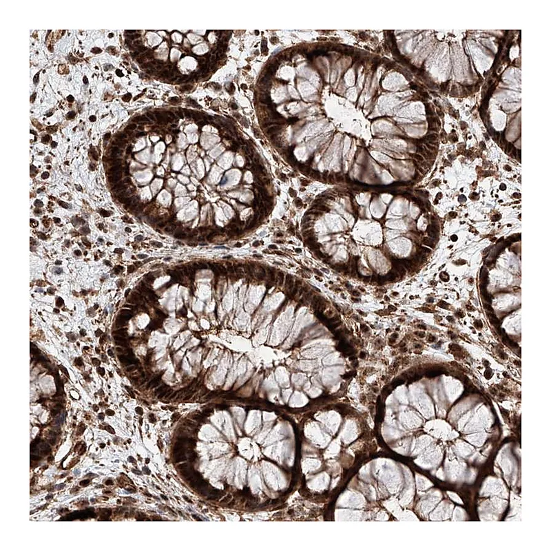 Atlas Antibodies Anti-AIM1L Antibody