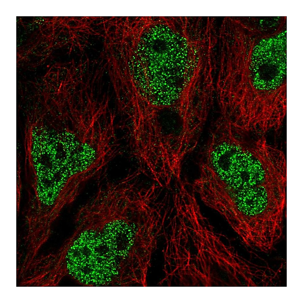 Atlas Antibodies Anti-AIM1L Antibody