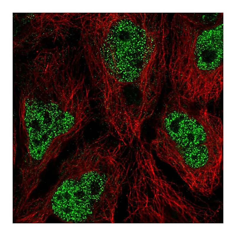 Atlas Antibodies Anti-AIM1L Antibody