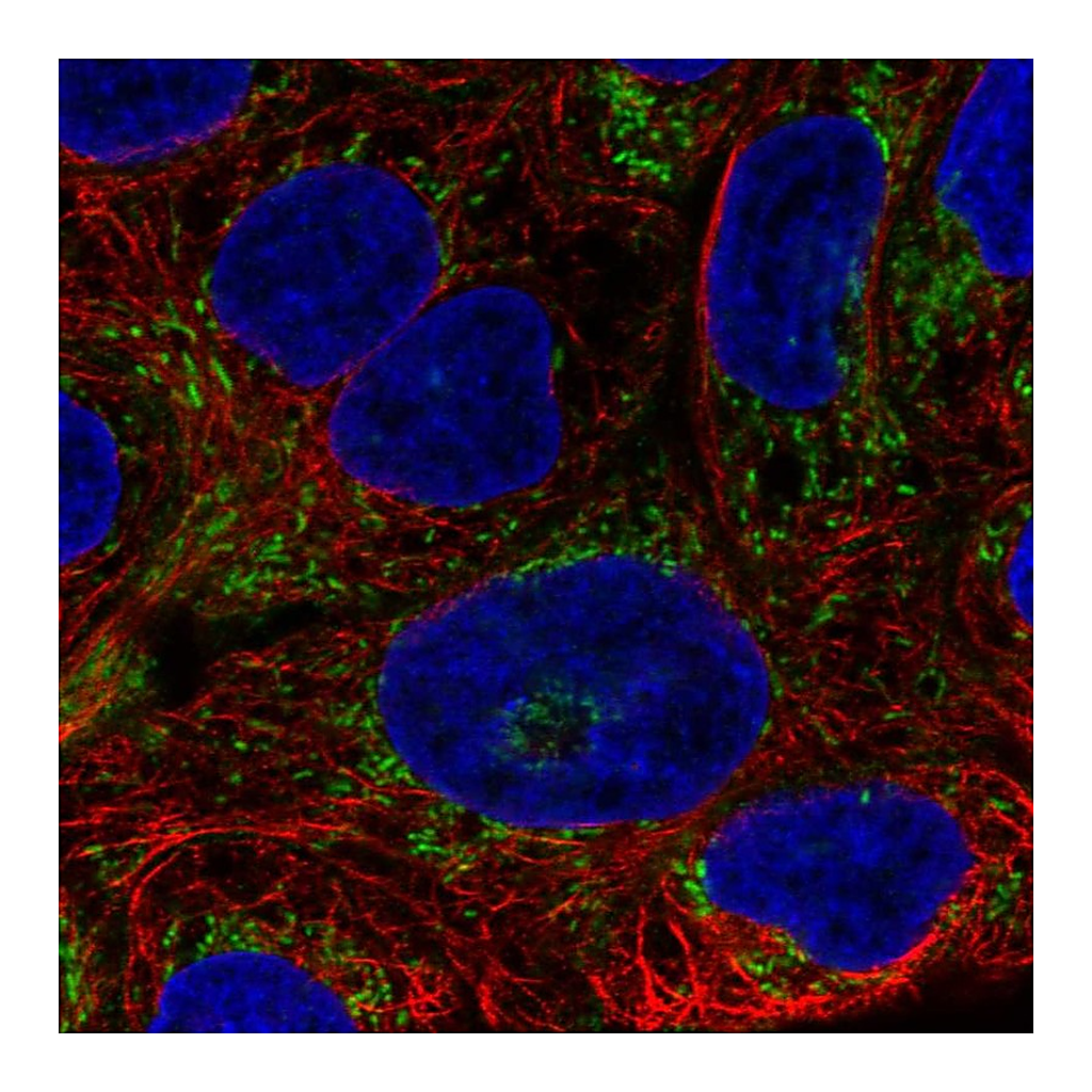Atlas Antibodies Anti-AIM2 Antibody
