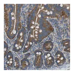 Atlas Antibodies Anti-AIMP1 Antibody