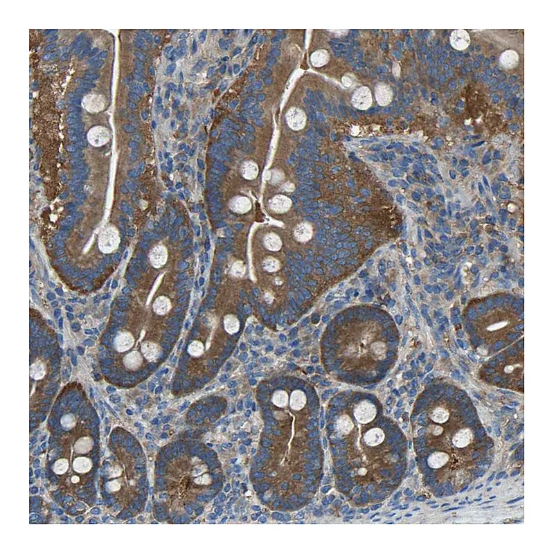 Atlas Antibodies Anti-AIMP1 Antibody