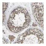 Atlas Antibodies Anti-AIMP2 Antibody