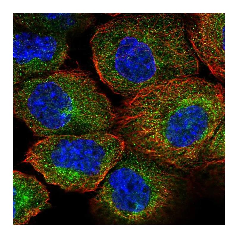 Atlas Antibodies Anti-AIP Antibody