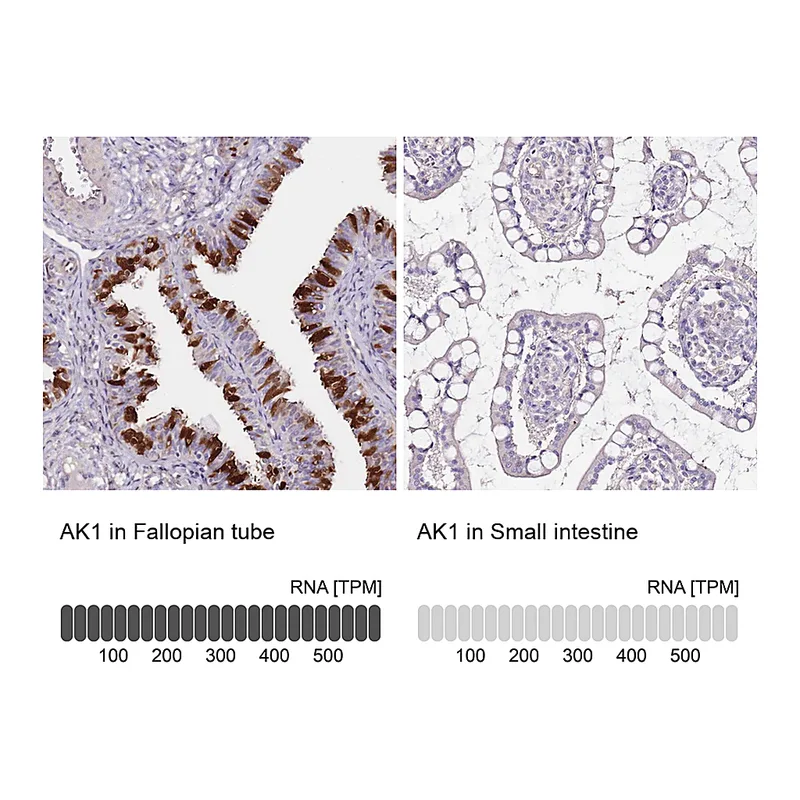Atlas Antibodies Anti-AK1 Antibody