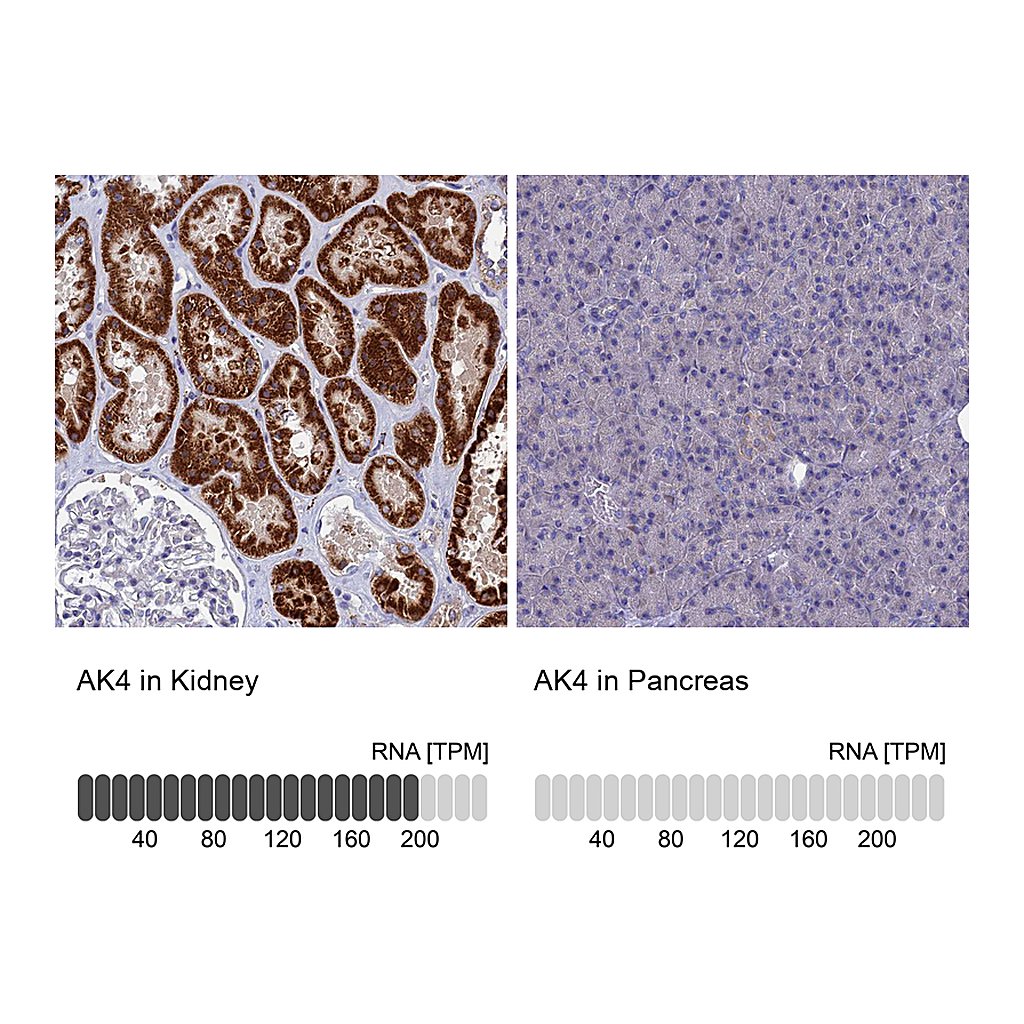 Atlas Antibodies Anti-AK4 Antibody