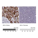 Atlas Antibodies Anti-AK4 Antibody