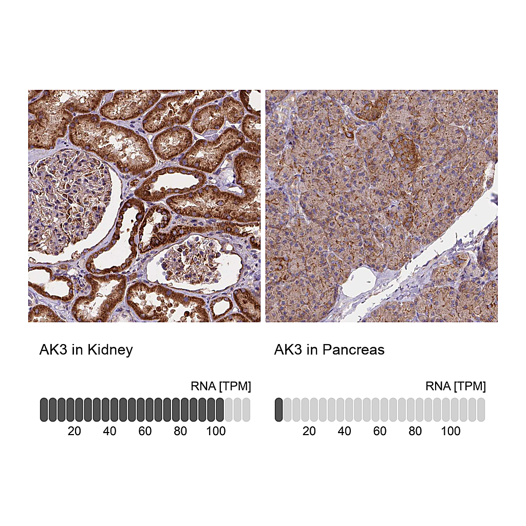 Atlas Antibodies Anti-AK3 Antibody