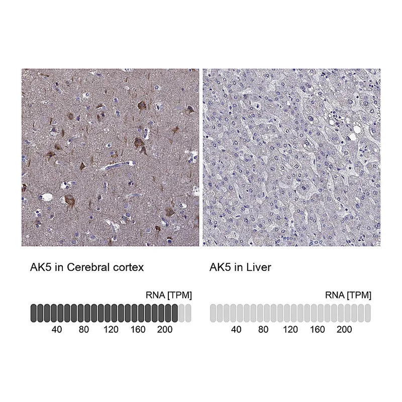 Atlas Antibodies Anti-AK5 Antibody