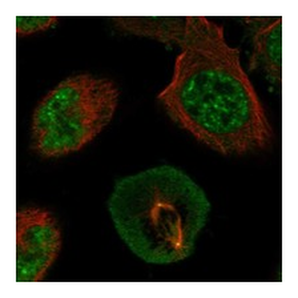 Atlas Antibodies Anti-AK6 Antibody