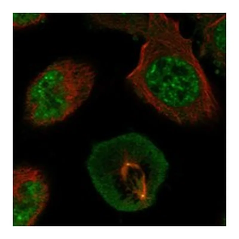 Atlas Antibodies Anti-AK6 Antibody