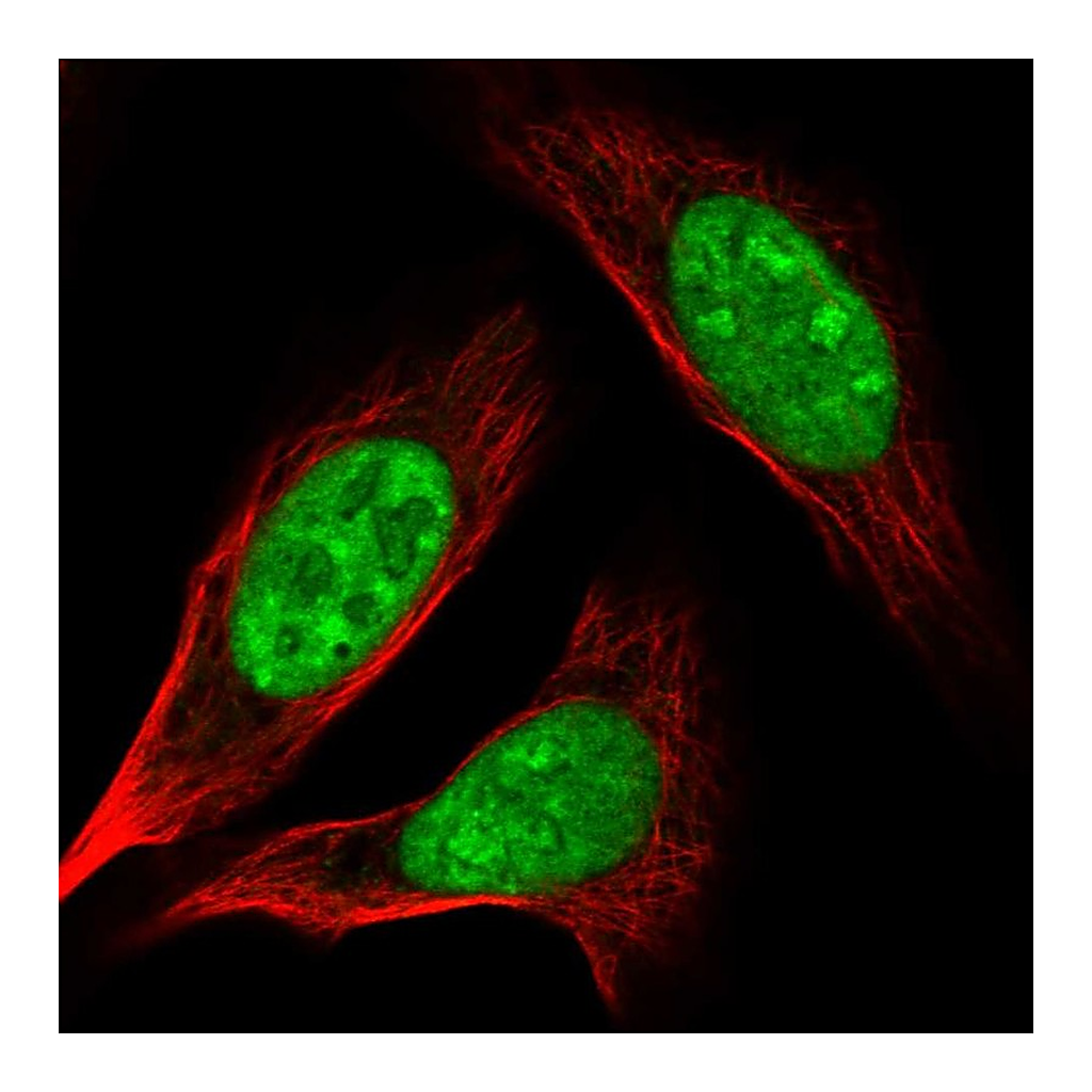 Atlas Antibodies Anti-AK6 Antibody