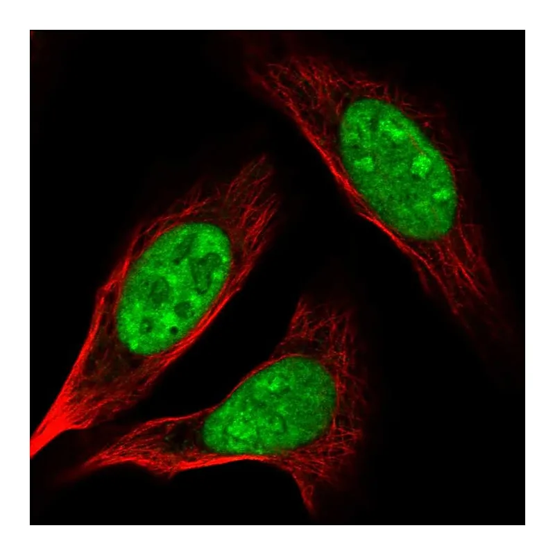 Atlas Antibodies Anti-AK6 Antibody