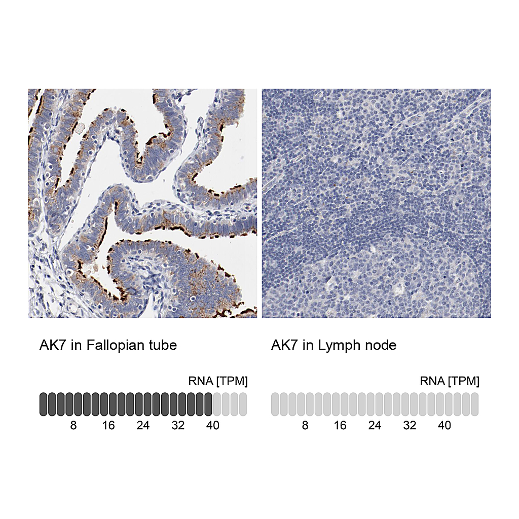Atlas Antibodies Anti-AK7 Antibody
