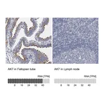 Atlas Antibodies Anti-AK7 Antibody