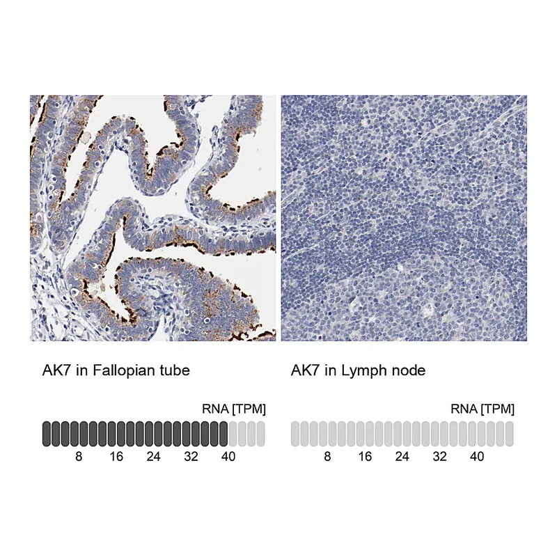 Atlas Antibodies Anti-AK7 Antibody