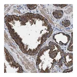 Atlas Antibodies Anti-AK8 Antibody
