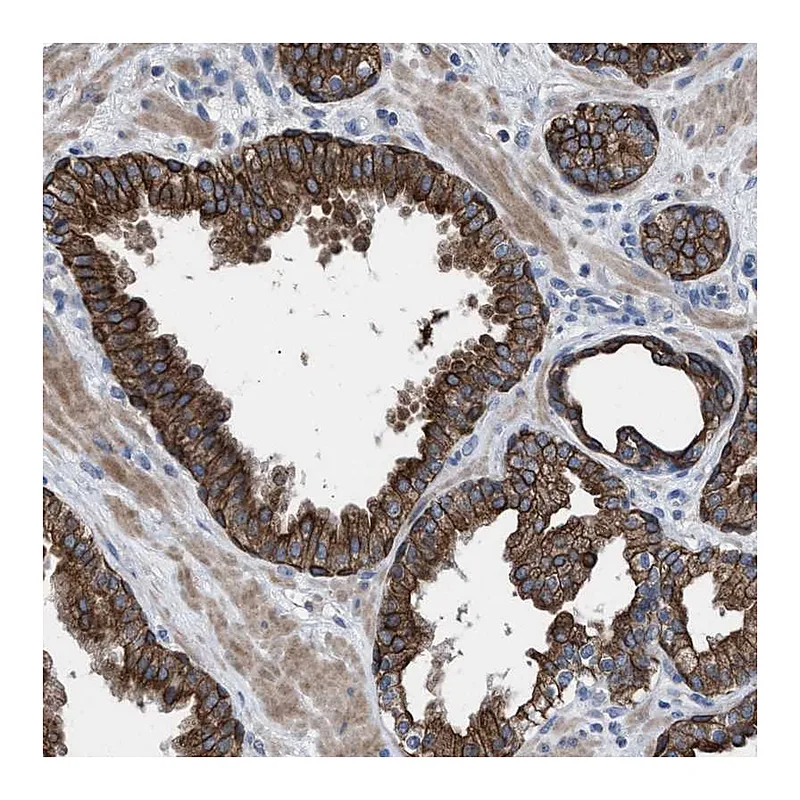 Atlas Antibodies Anti-AK8 Antibody