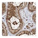 Atlas Antibodies Anti-AK9 Antibody