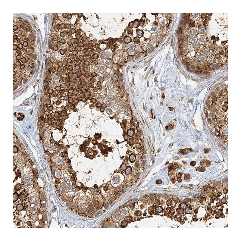 Atlas Antibodies Anti-AK9 Antibody