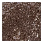 Atlas Antibodies Anti-AK9 Antibody