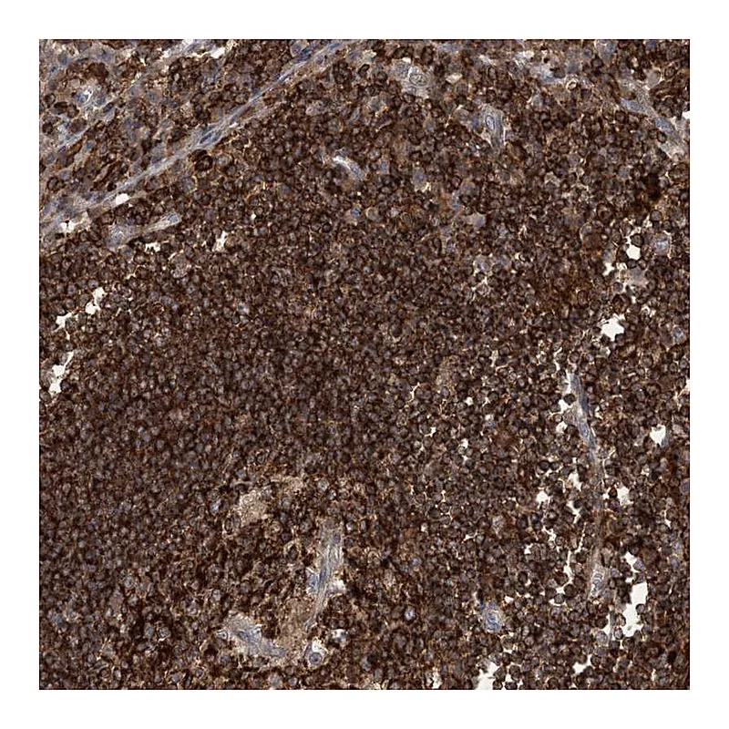 Atlas Antibodies Anti-AK9 Antibody