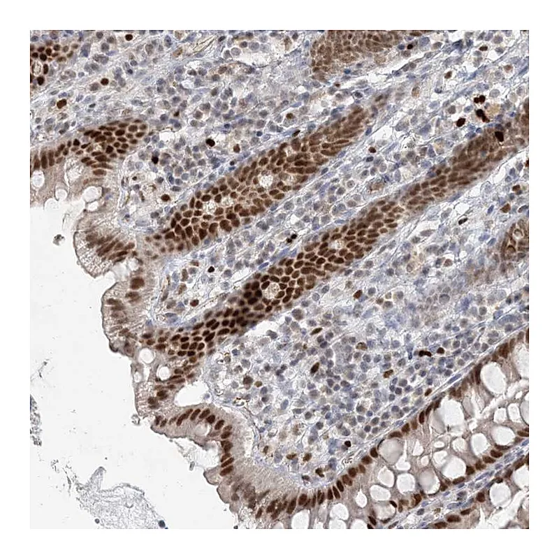 Atlas Antibodies Anti-AK9 Antibody