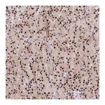 Atlas Antibodies Anti-AK9 Antibody