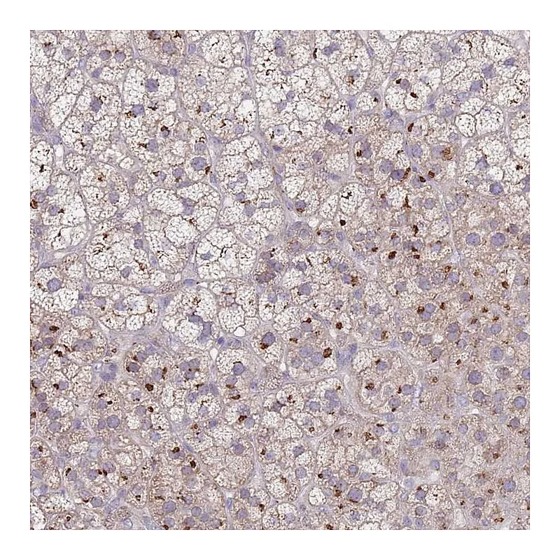 Atlas Antibodies Anti-AKAIN1 Antibody