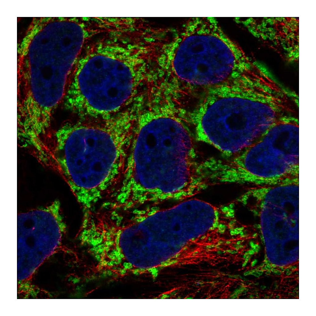 Atlas Antibodies Anti-AKAP1 Antibody