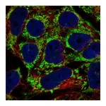 Atlas Antibodies Anti-AKAP1 Antibody